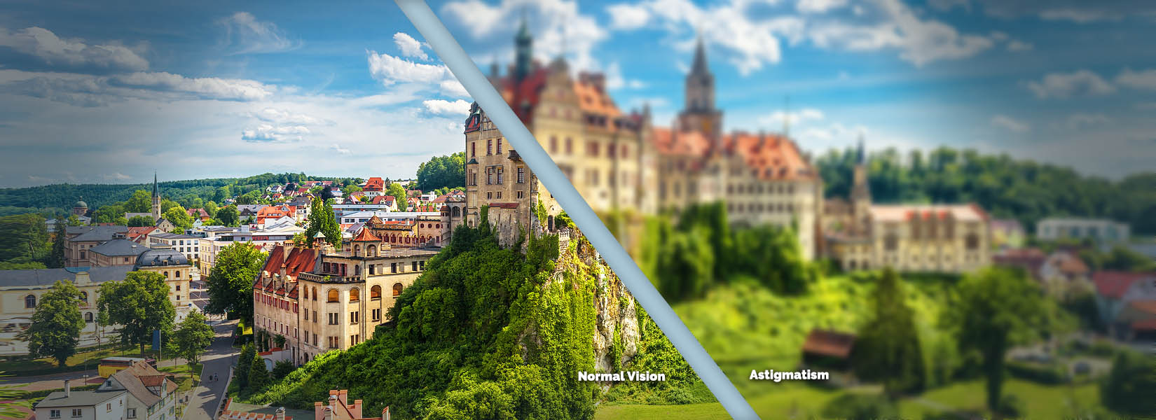Astigmatism Treatment in Far West Side